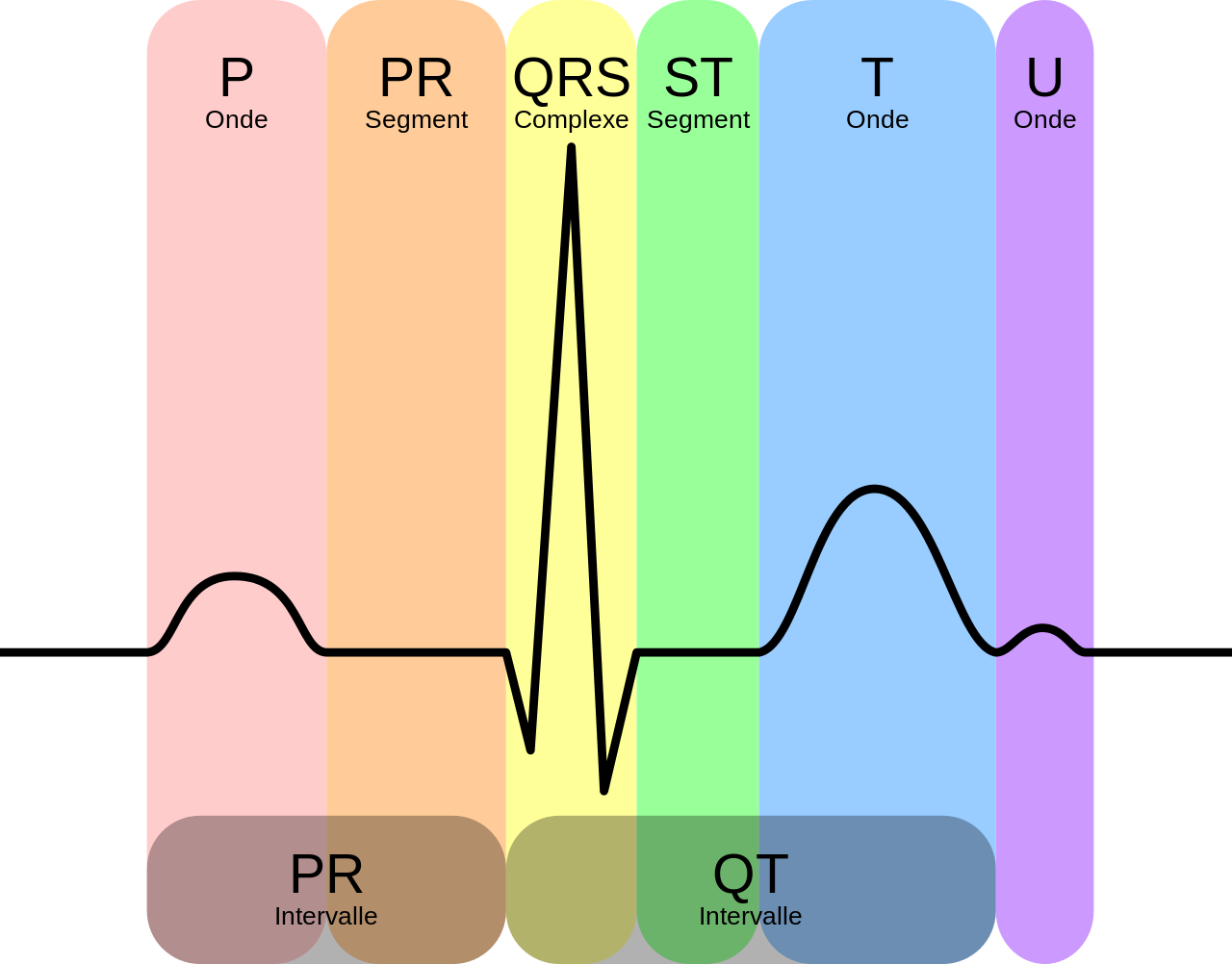 ecg